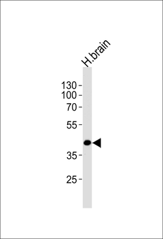 SEPT5 Antibody (N-term)