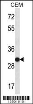 SNRPA Antibody (Center)