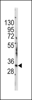 BRDG 1 Antibody (N-term F56)