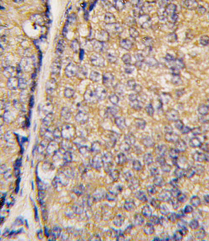BRDG 1 Antibody (N-term F56)