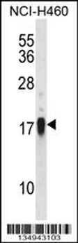 CD70 Antibody (Center)