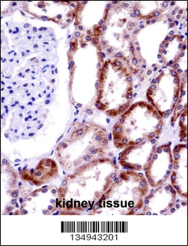 CD70 Antibody (Center)