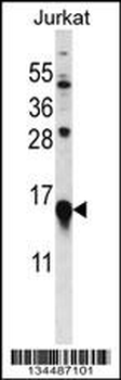 MYL9 Antibody (C-term)