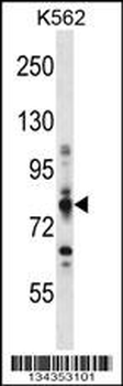CPT1A Antibody (C-term)