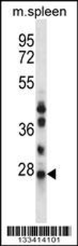 NQO2 Antibody (N-term)