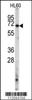 PDE8A Antibody (Center) (L572)