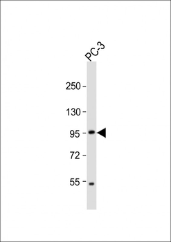 Mouse Pkn3 Antibody (N-term)