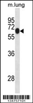 Mouse Dyrk1b Antibody (Center)