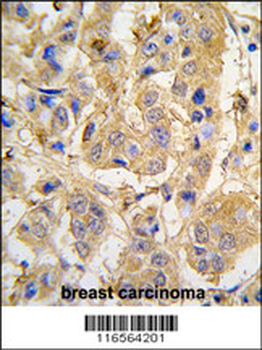 MIPEP Antibody (Center)