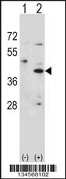 HSD3B1 Antibody (N-term)