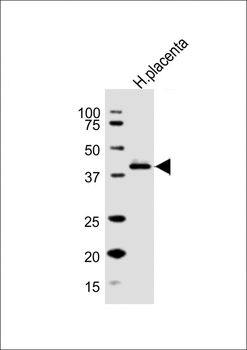 HSD3B1 Antibody (N-term)