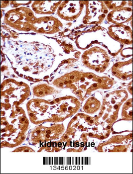 SET Antibody (N-term)
