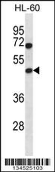 HAT1 Antibody (N-term)