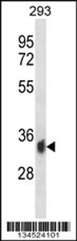 PPP6C Antibody (C-term)