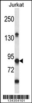 PTPRN Antibody (Center)