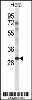 NHEJ1 Antibody (C-term)