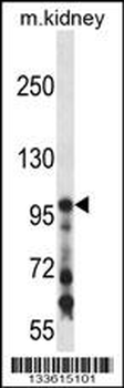COL1A1 Antibody (C-term)