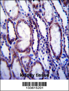 COL1A1 Antibody (C-term)