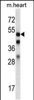 Mouse Mapkapk5 Antibody (N-term)