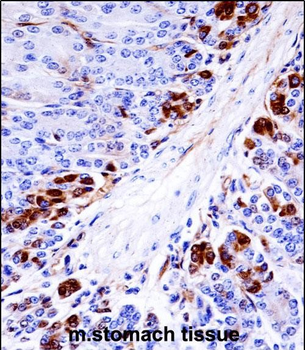 Mouse Mapkapk5 Antibody (N-term)