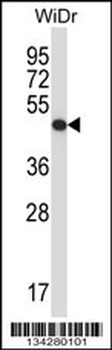 UQCRC2 Antibody (Center)