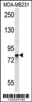 PADI2 Antibody (C-term)