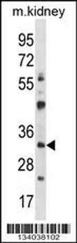 GTF2B Antibody (N-term)