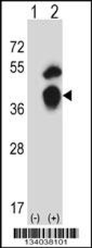 GTF2B Antibody (N-term)