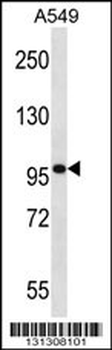 SYNPO Antibody (C-term)