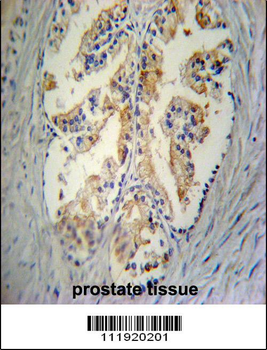 STC2 Antibody (C-term)