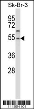 PPM1A Antibody