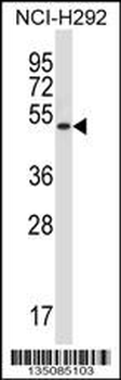 Mouse Rage Antibody (N-term)