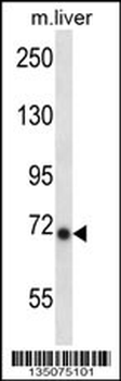 Mouse Ikbke Antibody (Center)