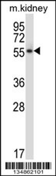 Mouse Plk5 Antibody (N-term)