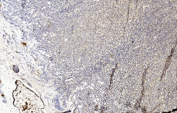 MLKL Rabbit Polyclonal Antibody