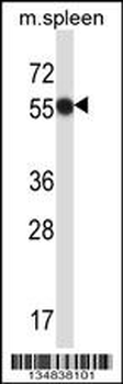 Mouse Matk Antibody (C-term)