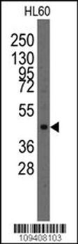 Lmx1a Antibody (Center)