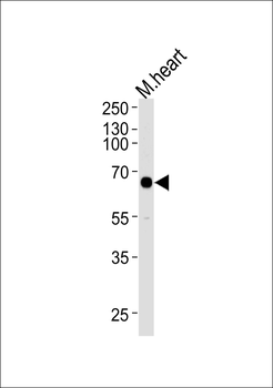 Mouse Mapkapk3 Antibody (N-term)