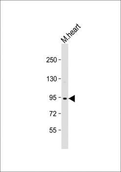 Mouse TRPV3 Antibody (N-term)