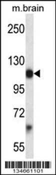 Mouse Pdgfra Antibody (Center)