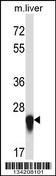 IL27 Antibody (Center)