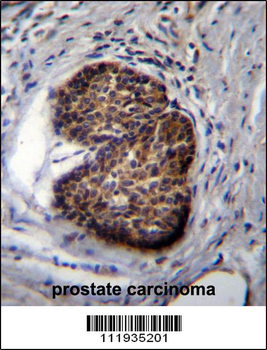 PSCA Antibody (Center)
