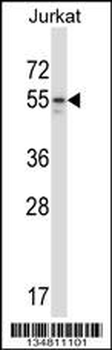Mouse Map2k7 Antibody (Center)