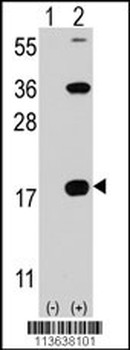 CD3Z Antibody (C-term)