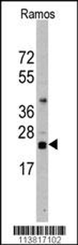 CD3Z Antibody (N-term)