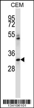 IBSP Antibody (N-term)