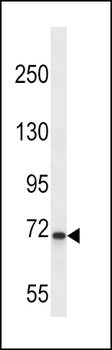 KLKB1 Antibody (C-term)
