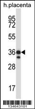 Mouse Mst4 Antibody (Center)