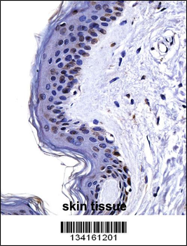 CSRP2 Antibody (Center)