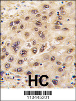 Nucleostemin (GNL3) Antibody (C-term)